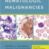 Handbook of Hematologic Malignancies PDF