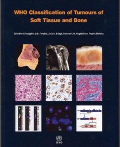 WHO Classification of Tumours of Soft Tissue and Bone (IARC WHO Classification of Tumours) 4th Edition PDF