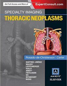 Specialty Imaging Thoracic Neoplasms, 1e Edition PDF