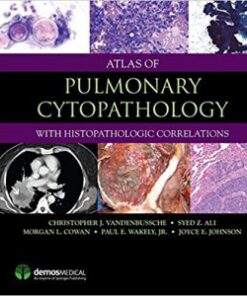 Atlas of Pulmonary Cytopathology PDF