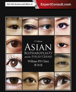 Asian Blepharoplasty and the Eyelid Crease, 3e PDF & VIDEO