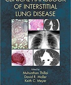 Clinical Handbook of Interstitial Lung Disease 1st Edition PDF