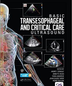 Basic Transesophageal and Critical Care Ultrasound 1st Edition PDF