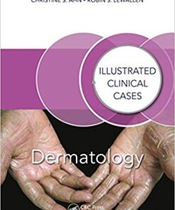 Dermatology: Illustrated Clinical Cases 1st Edition PDF