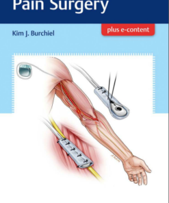 Handbook of Pain Surgery 1st Edition PDF