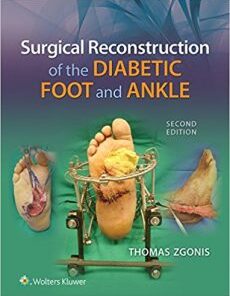 Surgical Reconstruction of the Diabetic Foot and Ankle 2nd Edition epub