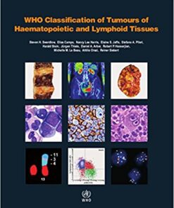 WHO Classification of Tumours of Haematopoietic and Lymphoid Tissues (IARC WHO Classification of Tumours) Revised Edition PDF