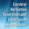 Cerebral Herniation Syndromes and Intracranial Hypertension (Updates in Neurocritical Care) 1st Edition PDF