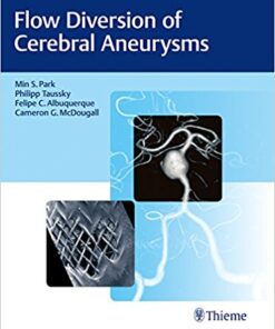 Flow Diversion of Cerebral Aneurysms 1st Edition PDF