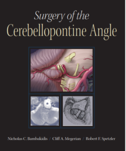 Surgery of the Cerebellopontine Angle 1st Edition PDF