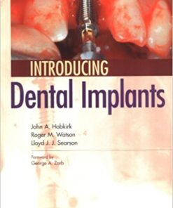 Introducing Dental Implants, 1e 1st Edition PDF