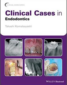 Clinical Cases in Endodontics PDF