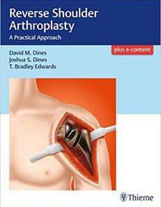 Reverse Shoulder Arthroplasty: A Practical Approach PDF