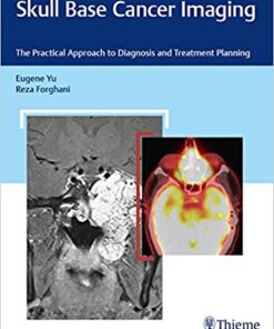 Skull Base Cancer Imaging: The Practical Approach to Diagnosis and Treatment Planning 1st Edition PDF