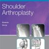 Shoulder Arthroplasty 2nd Edition PDF & Video