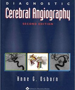 Diagnostic Cerebral Angiography Second Edition PDF