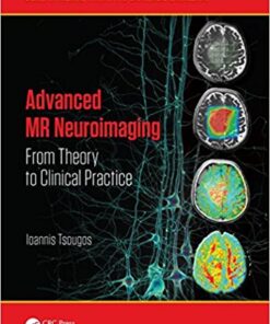 Advanced MR Neuroimaging: From Theory to Clinical Practice (Series in Medical Physics and Biomedical Engineering) 1st Edition PDF