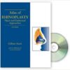 Atlas of Rhinoplasty, Second Edition 2nd Edition PDF