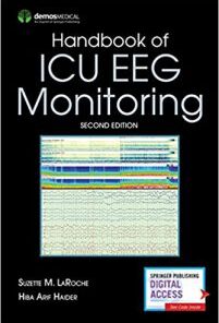 Handbook of ICU EEG Monitoring 2nd Edition PDF