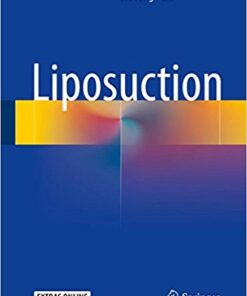 Liposuction 1st ed. 2018 Edition PDF