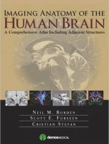 Imaging Anatomy of the Human Brain PDF