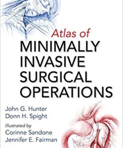 Atlas of Minimally Invasive Surgical Operations 1st Edition PDF