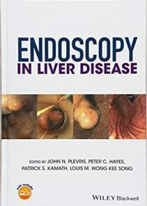 Endoscopy in Liver Disease PDF