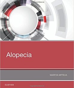 Alopecia, 1e 1st Edition PDF