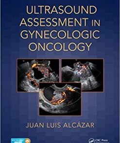 Ultrasound Assessment in Gynecologic Oncology 1st Edition PDF