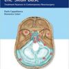 Meningiomas of the Skull Base: Treatment Nuances in Contemporary Neurosurgery PDF