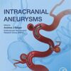 Intracranial Aneurysms PDF