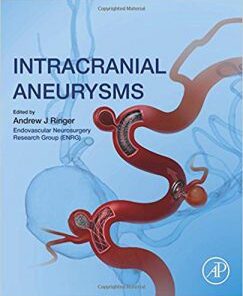 Intracranial Aneurysms PDF