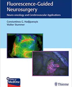 Fluorescence-Guided Neurosurgery: Neuro-oncology and Cerebrovascular Applications 1st Edition PDF