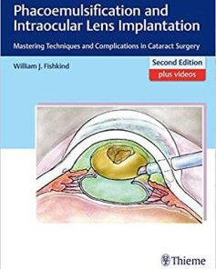 Phacoemulsification and Intraocular Lens Implantation: Mastering Techniques and Complications in Cataract Surgery 2nd Edition PDF