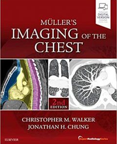 Muller’s Imaging of the Chest: Expert Radiology Series 2nd Edition PDF