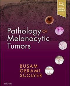 Pathology of Melanocytic Tumors PDF