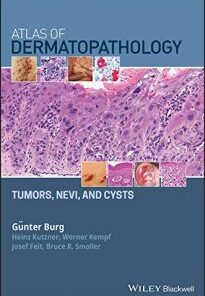 Atlas of Dermatopathology: Tumors, Nevi, and Cysts PDF