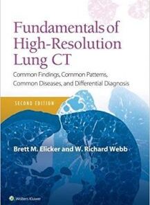 Fundamentals of High-Resolution Lung CT: Common Findings, Common Patterns, Common Diseases and Differential Diagnosis 2nd Edition PDF