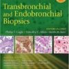 Transbronchial and Endobronchial Biopsies