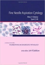 Fine Needle Aspiration Cytology: A Volume in Foundations in Diagnostic Pathology, 1e