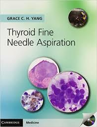 Thyroid Fine Needle Aspiration