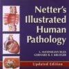 Netter's Illustrated Human Pathology Updated Edition: with Student Consult Access, 1e