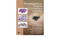 Dermatopathology Primer of Cutaneous Tumors PDF