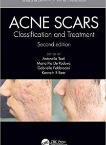 Acne Scars: Classification and Treatment, 2nd Edition PDF