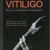 Vitiligo Medical and Surgical Management PDF