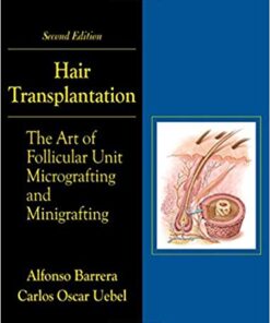 Hair Transplantation: The Art of Micrografting and Minigrafting, Second Edition 2nd Edition PDF