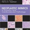 Neoplastic Mimics in Thoracic and Cardiovascular Pathology