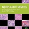 Neoplastic Mimics in Gastrointestinal and Liver Pathology