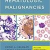 Handbook of Hematologic Malignancies