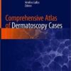 Comprehensive Atlas of Dermatoscopy Cases 1st ed. 2018 Edition